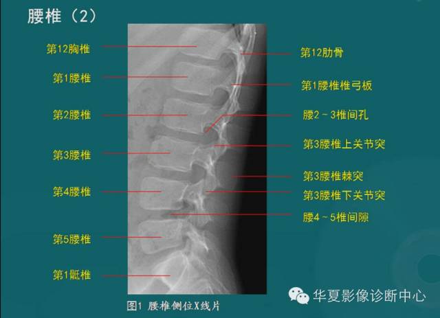 影像PPT - 史上最全断层解剖图谱-12