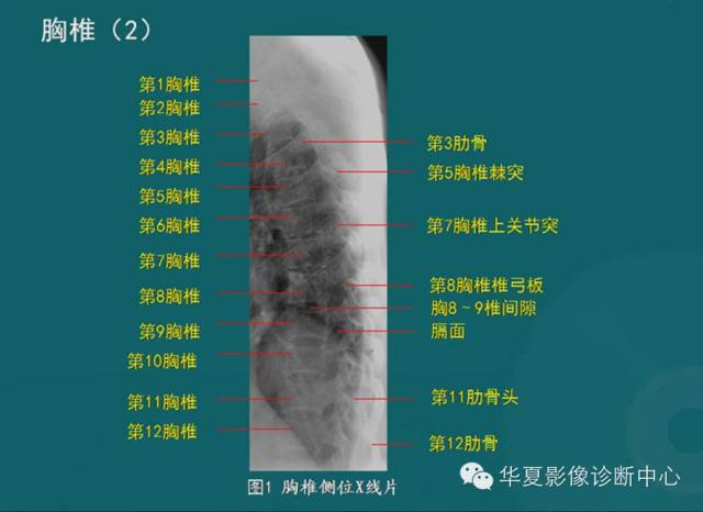影像PPT - 史上最全断层解剖图谱-10