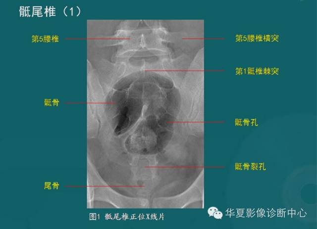 影像PPT - 史上最全断层解剖图谱-14
