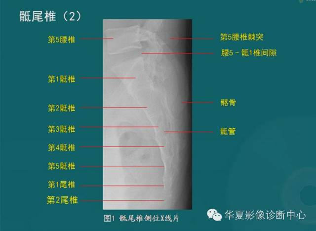 影像PPT - 史上最全断层解剖图谱-15