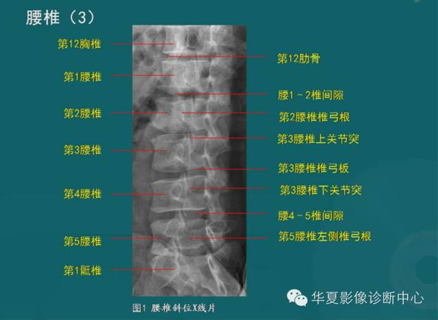影像PPT - 史上最全断层解剖图谱-13