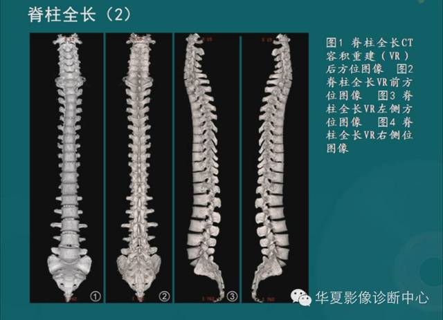 影像PPT - 史上最全断层解剖图谱-18