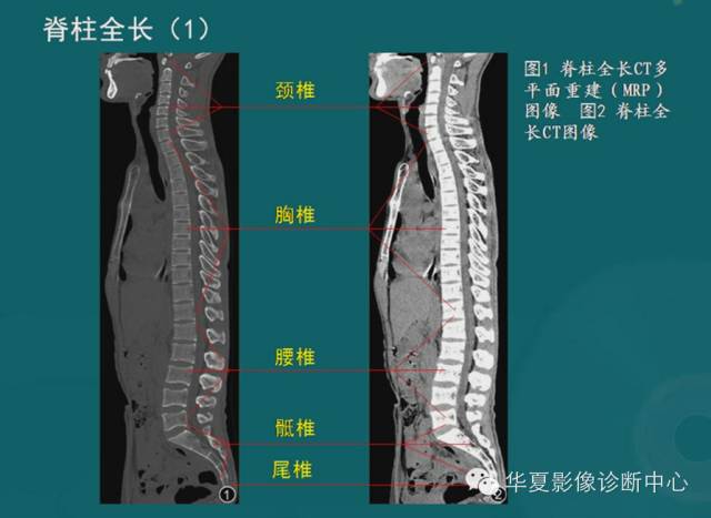 影像PPT - 史上最全断层解剖图谱-17
