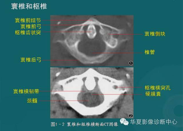 影像PPT - 史上最全断层解剖图谱-19
