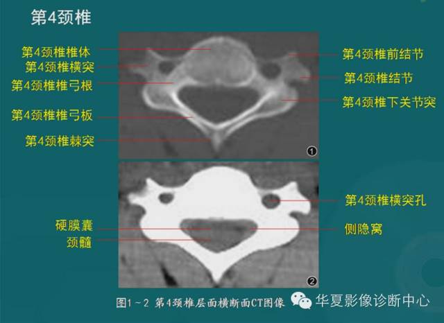 影像PPT - 史上最全断层解剖图谱-20