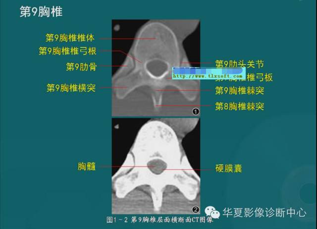 影像PPT - 史上最全断层解剖图谱-22