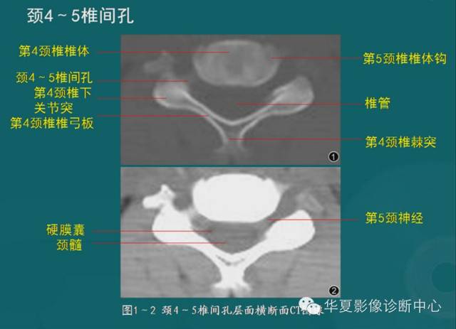 影像PPT - 史上最全断层解剖图谱-21