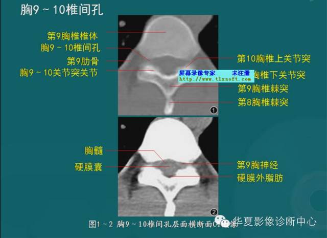 影像PPT - 史上最全断层解剖图谱-23