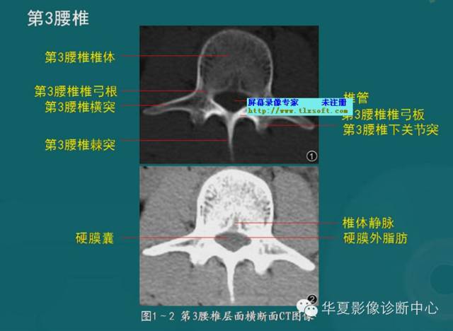 影像PPT - 史上最全断层解剖图谱-24