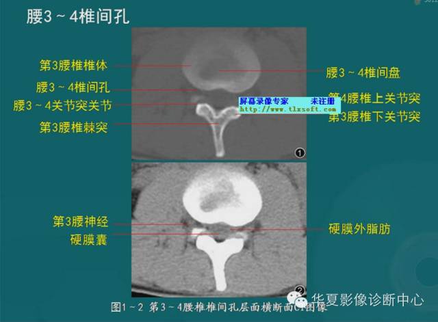 影像PPT - 史上最全断层解剖图谱-25