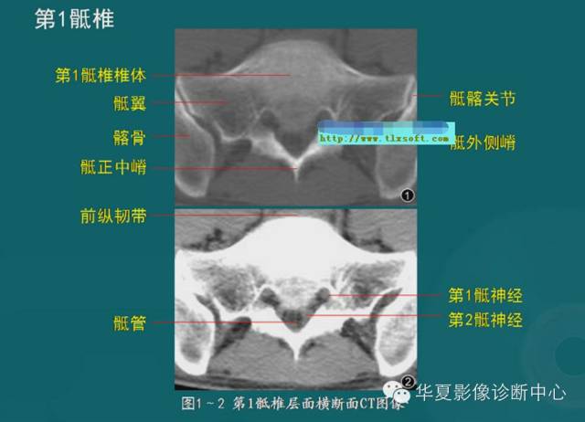 影像PPT - 史上最全断层解剖图谱-26