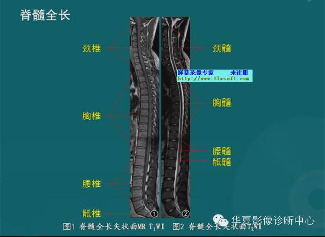 影像PPT - 史上最全断层解剖图谱-30