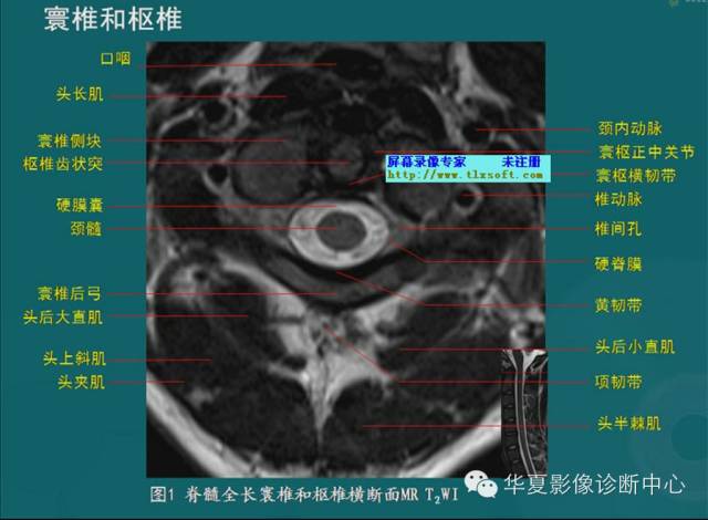 影像PPT - 史上最全断层解剖图谱-31