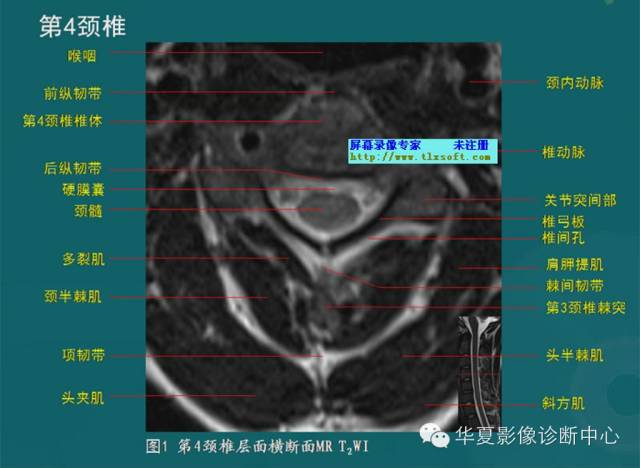 影像PPT - 史上最全断层解剖图谱-32