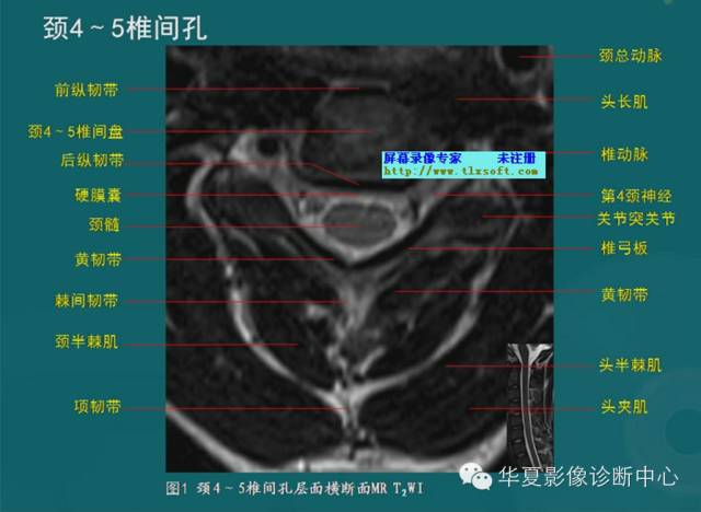 影像PPT - 史上最全断层解剖图谱-33