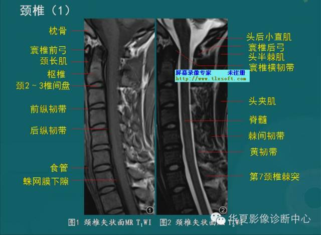 影像PPT - 史上最全断层解剖图谱-34