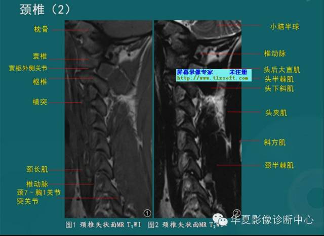 影像PPT - 史上最全断层解剖图谱-35