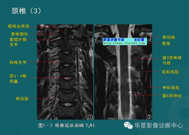 影像PPT - 史上最全断层解剖图谱-36