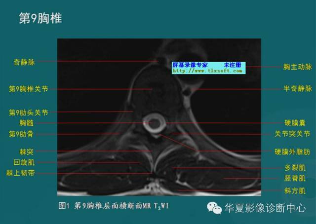 影像PPT - 史上最全断层解剖图谱-37
