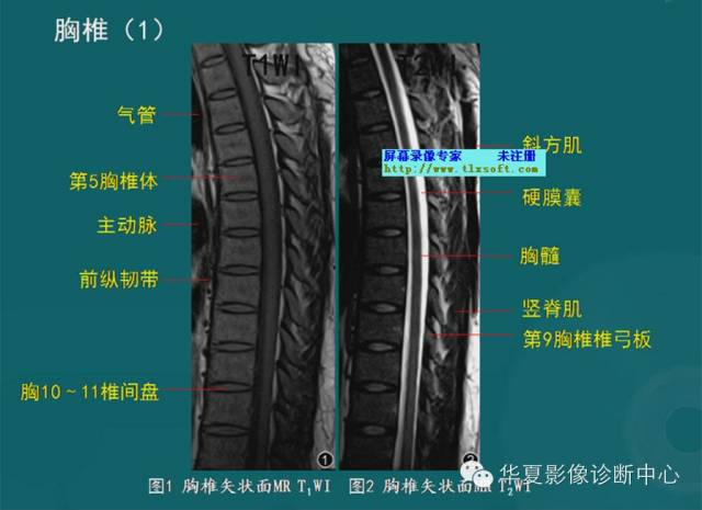 影像PPT - 史上最全断层解剖图谱-39