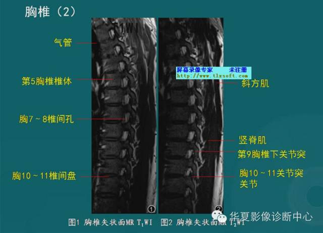 影像PPT - 史上最全断层解剖图谱-40