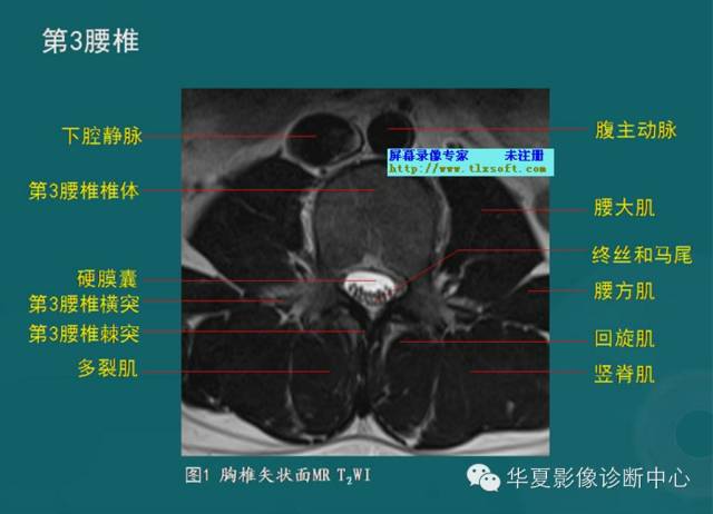 影像PPT - 史上最全断层解剖图谱-41