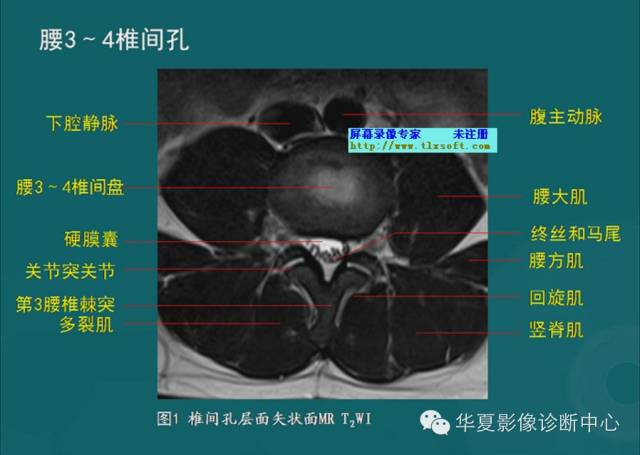 影像PPT - 史上最全断层解剖图谱-42