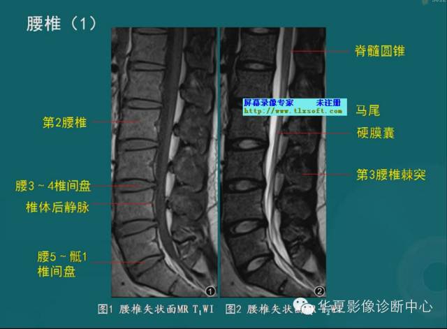 影像PPT - 史上最全断层解剖图谱-43