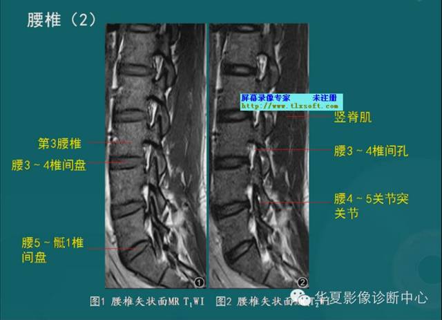 影像PPT - 史上最全断层解剖图谱-44