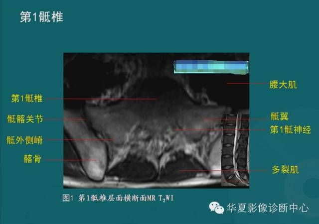 影像PPT - 史上最全断层解剖图谱-45