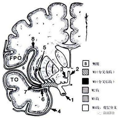 影像PPT - 史上最全断层解剖图谱-75