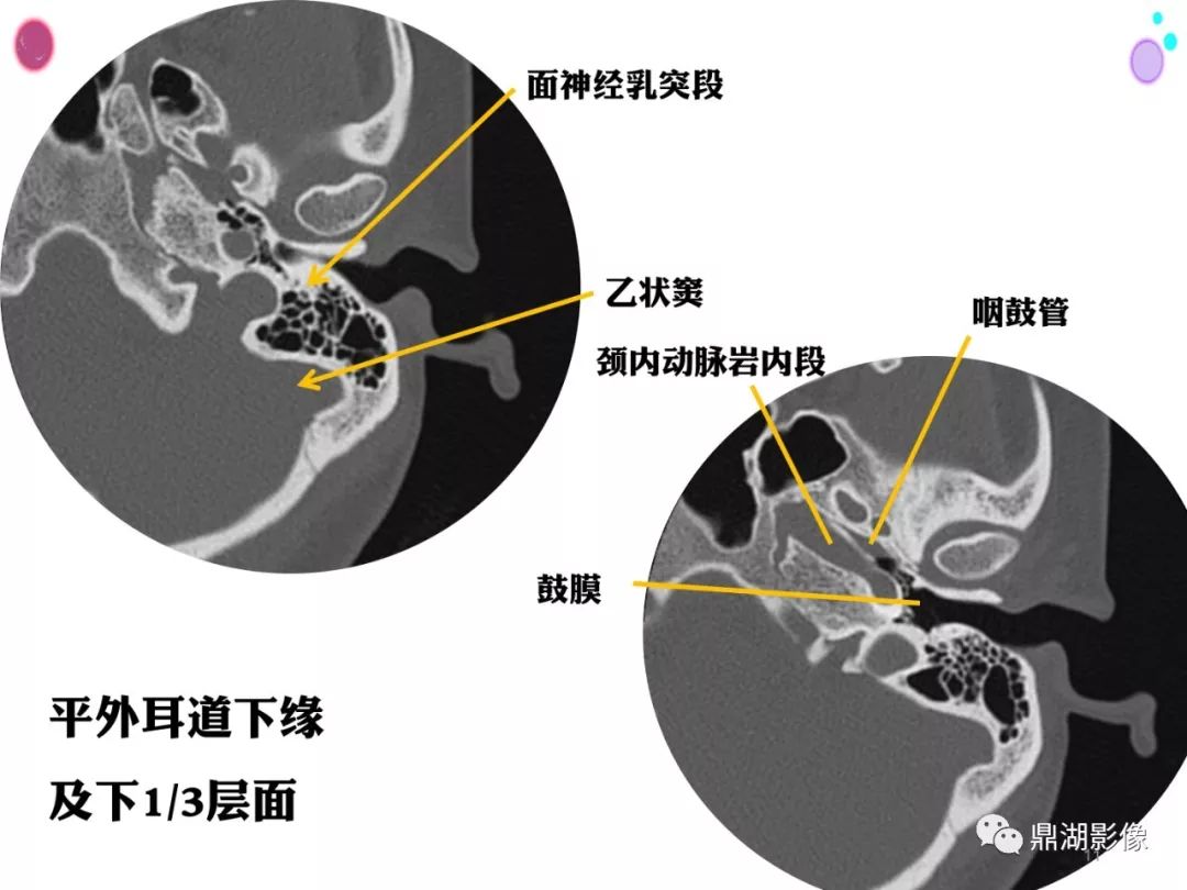 影像PPT - 史上最全断层解剖图谱-85