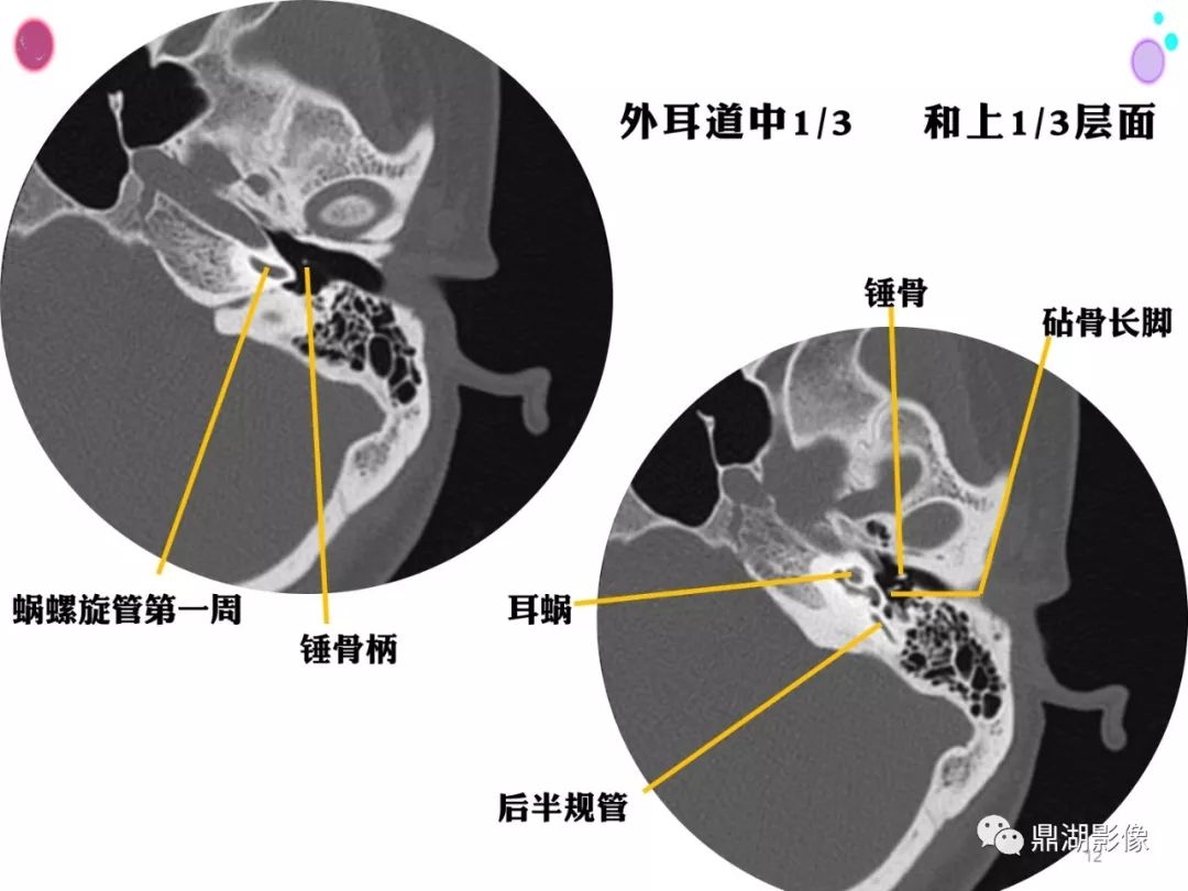 影像PPT - 史上最全断层解剖图谱-86