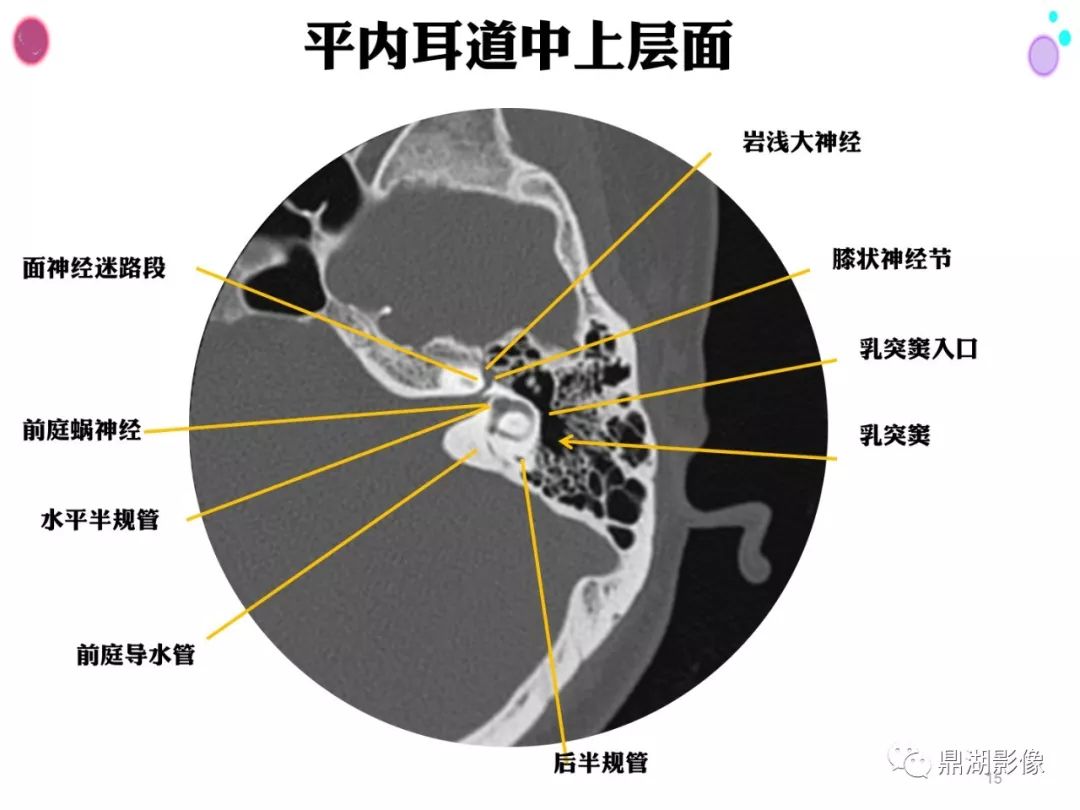 影像PPT - 史上最全断层解剖图谱-89