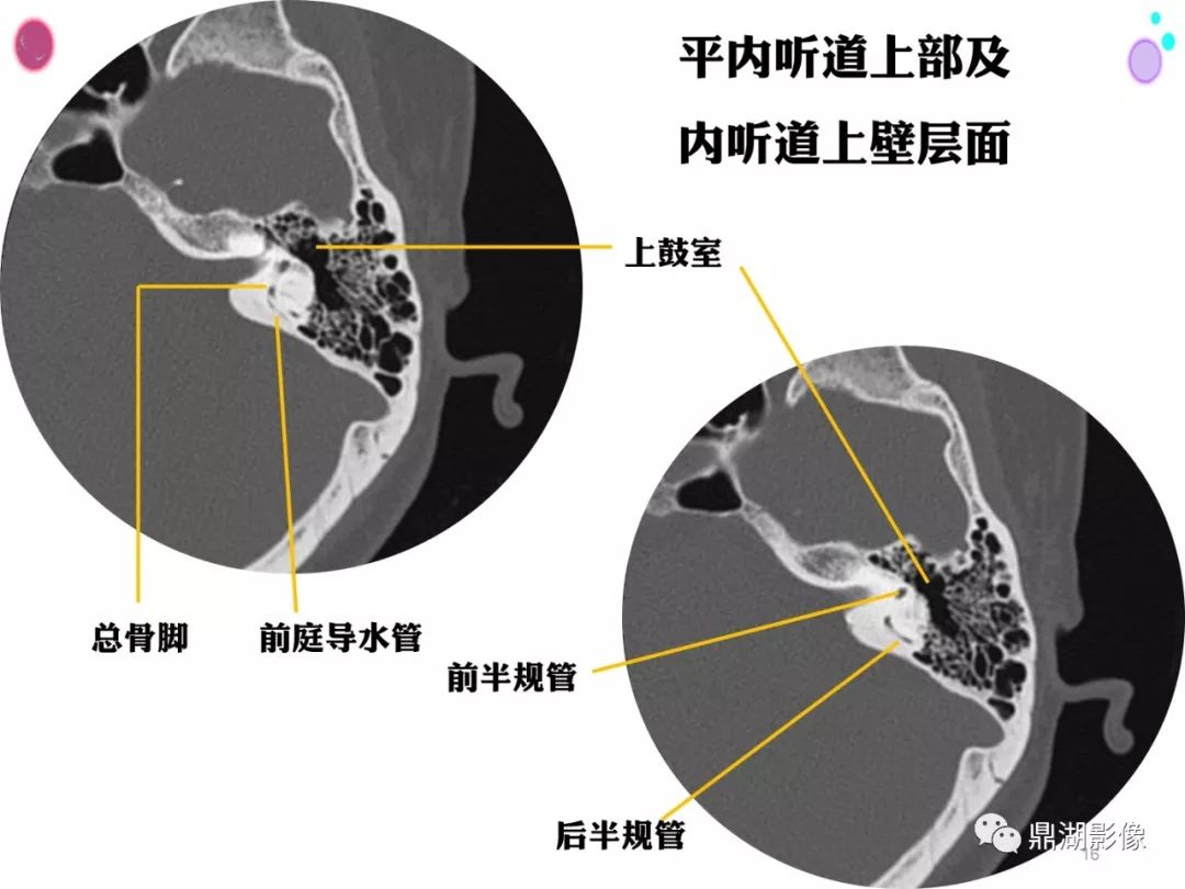 影像PPT - 史上最全断层解剖图谱-90