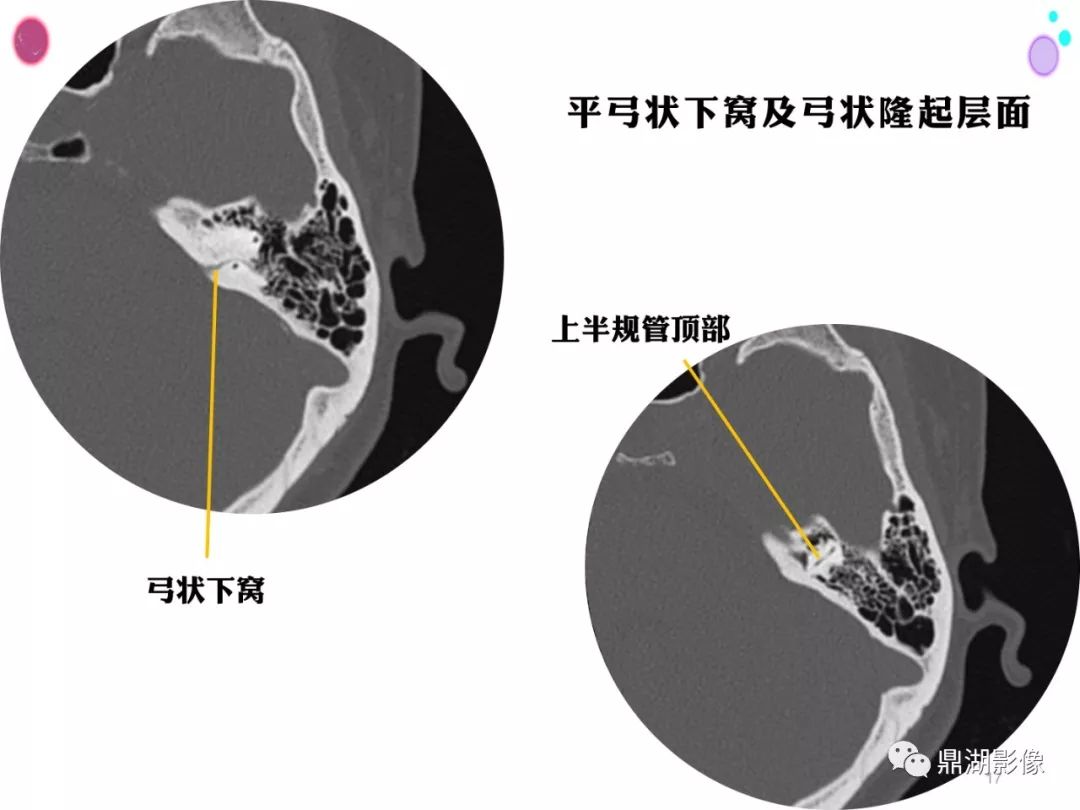 影像PPT - 史上最全断层解剖图谱-91