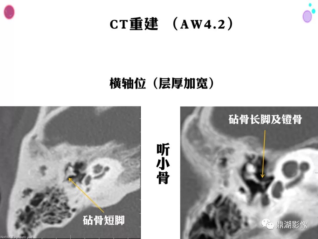 影像PPT - 史上最全断层解剖图谱-92