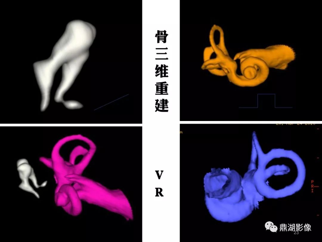 影像PPT - 史上最全断层解剖图谱-97