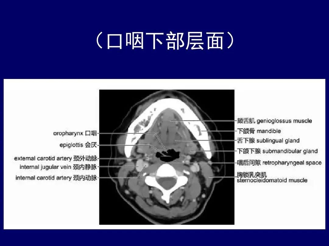 影像PPT - 史上最全断层解剖图谱-98