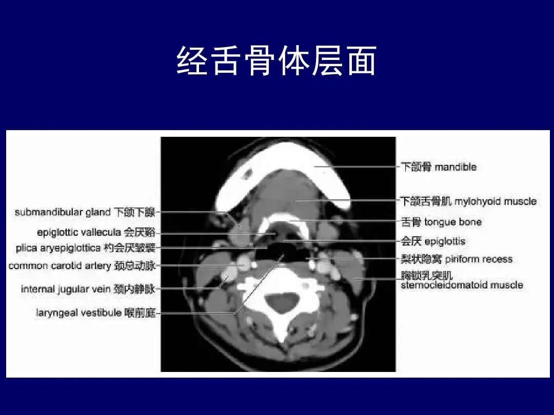 影像PPT - 史上最全断层解剖图谱-99