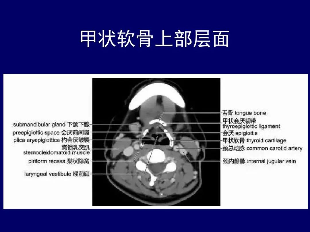影像PPT - 史上最全断层解剖图谱-100