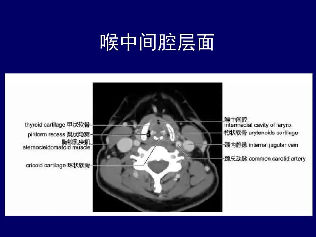 影像PPT - 史上最全断层解剖图谱-101