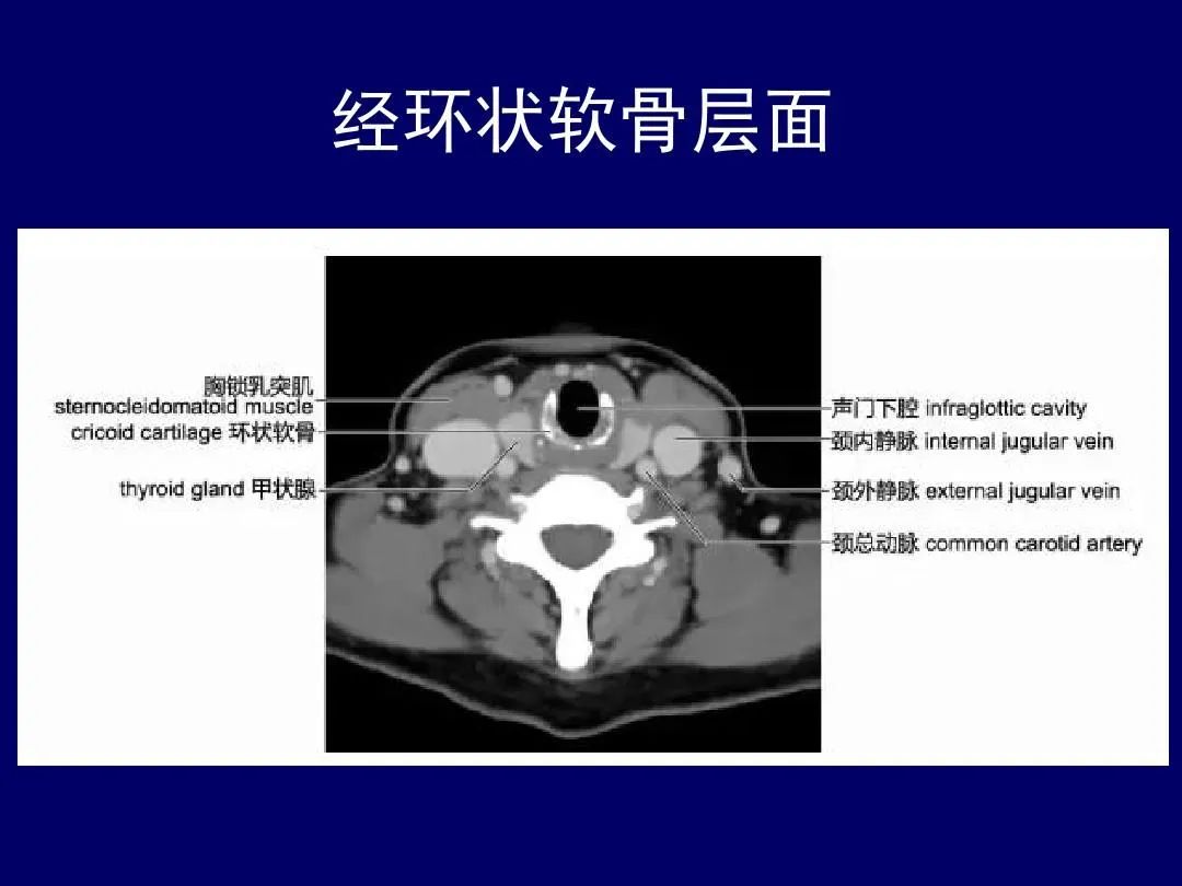 影像PPT - 史上最全断层解剖图谱-102