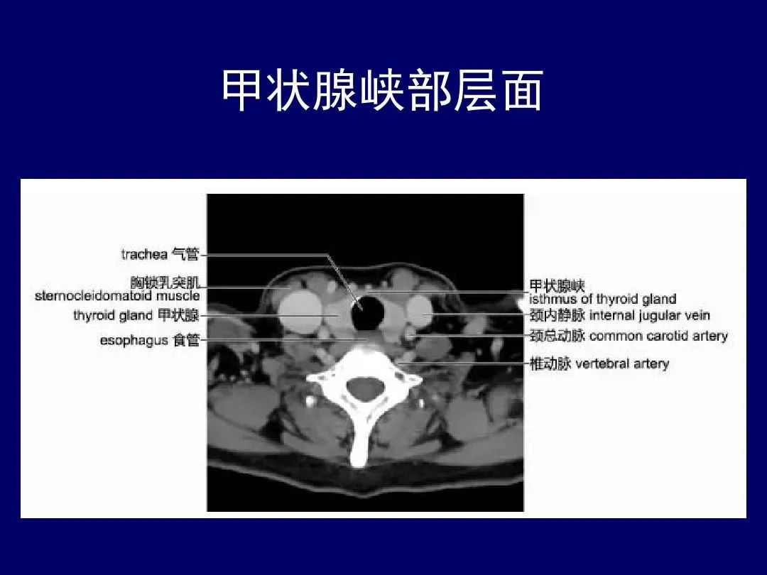影像PPT - 史上最全断层解剖图谱-103