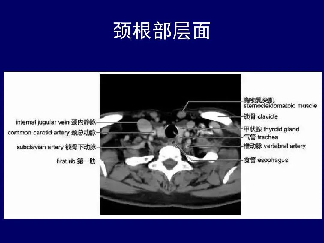 影像PPT - 史上最全断层解剖图谱-104