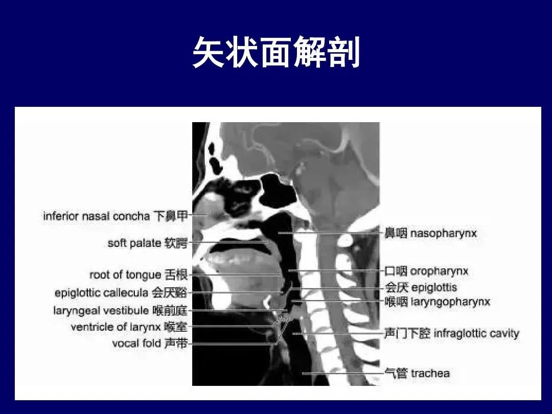 影像PPT - 史上最全断层解剖图谱-105