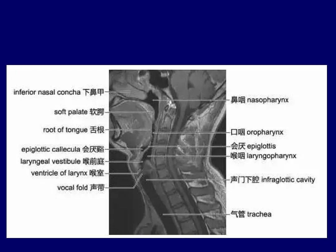 影像PPT - 史上最全断层解剖图谱-106