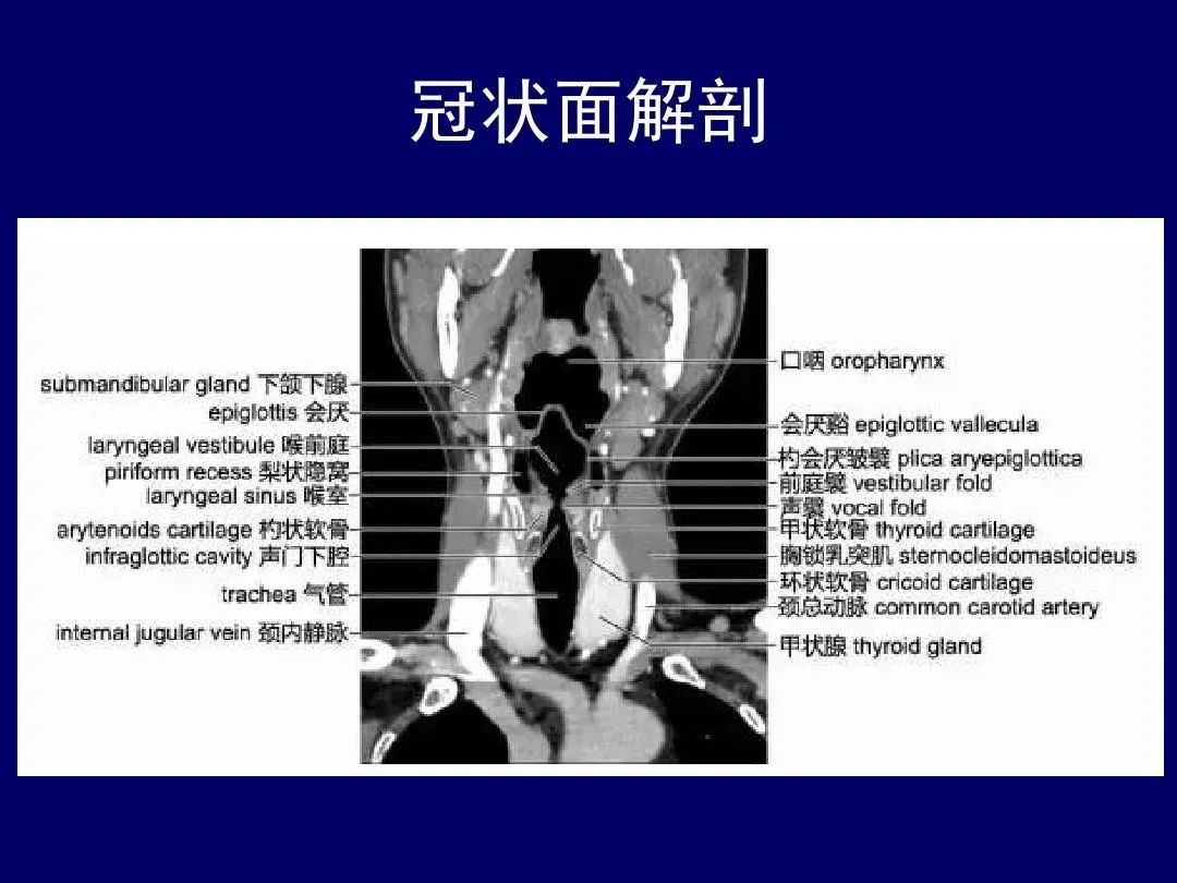 影像PPT - 史上最全断层解剖图谱-107