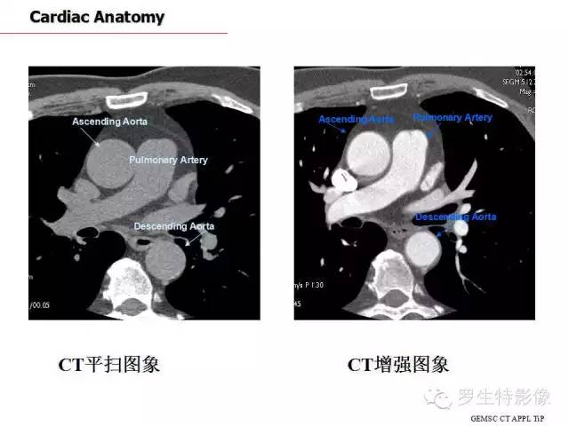 影像PPT - 史上最全断层解剖图谱-165