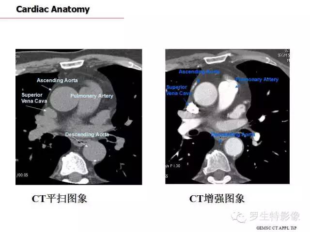 影像PPT - 史上最全断层解剖图谱-166